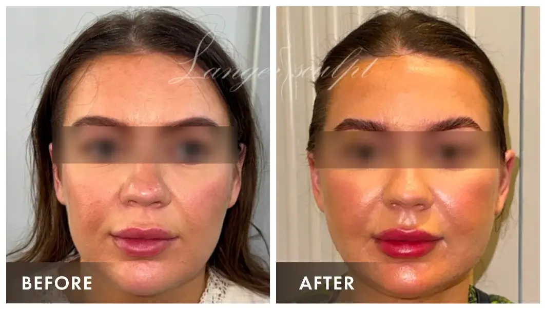 Stunning Result