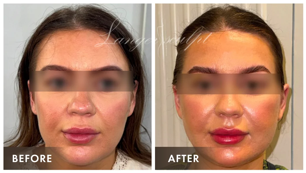 Stunning Result