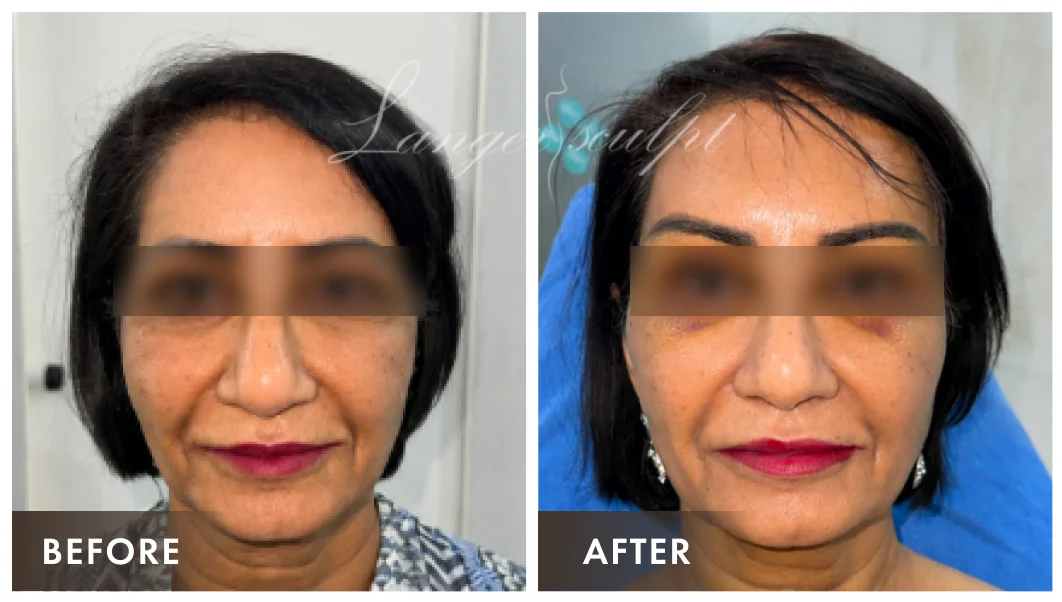 Stunning Result