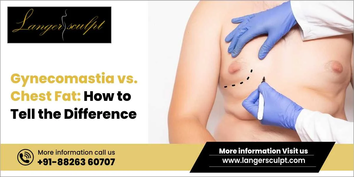 Gynecomastia vs. Chest Fat: How to Tell the Difference?