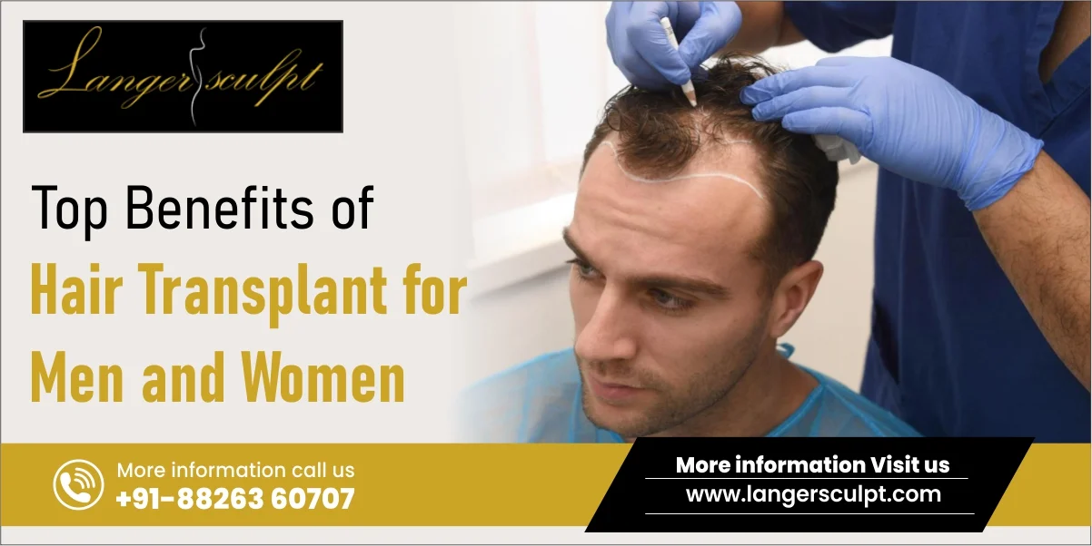 Top Benefits of Hair Transplant for Men and Women